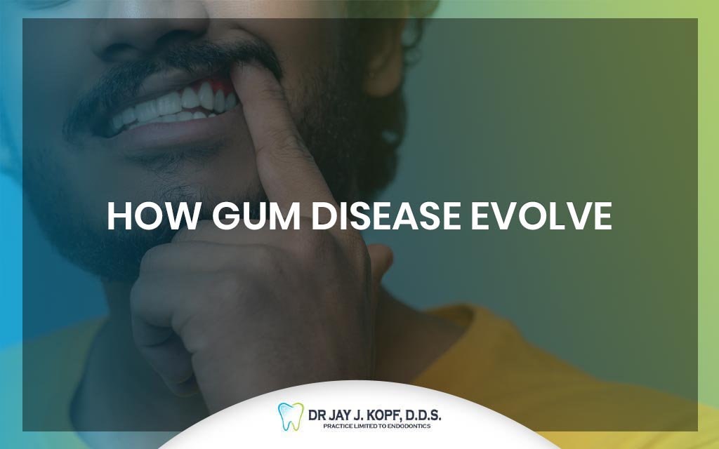 How gum disease evolve?