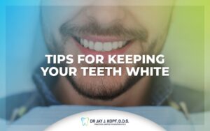 Read more about the article Tips for keeping your teeth white
